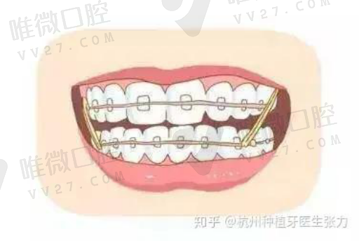 口腔诊所牙椅数目限制（口腔诊所两台牙椅需要几名医生）(图1)